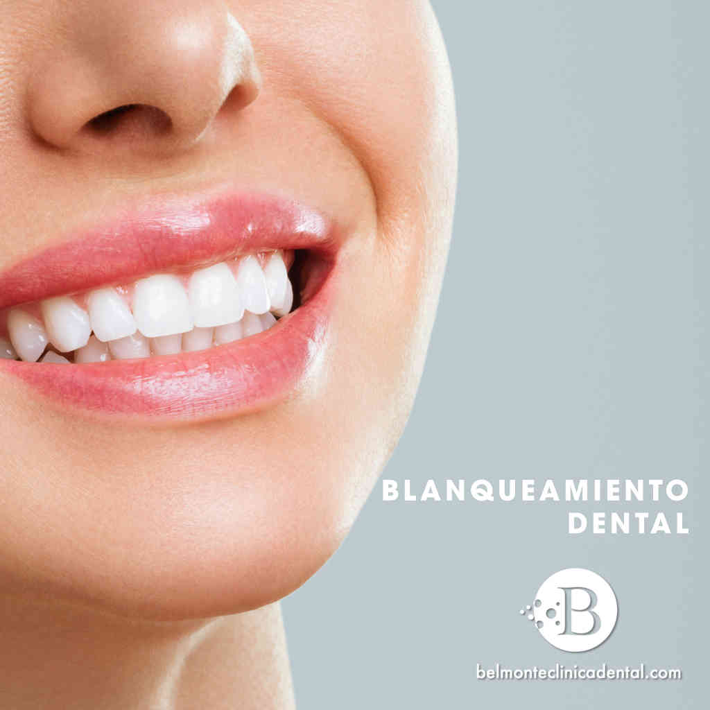 Blanqueamiento dental, ty