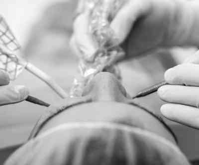 Tratamientos para la Periodoncia Dental o Periodontitis en Clínica de Albacete Belmonte Tratamientos para la Periodoncia Dental o Periodontitis en Clínica de Albacete Belmonte